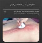 جهاز تجويف بالموجات فوق الصوتية احترافي 80 كيلو هرتز، ترددات راديوية 9 في 1، جهاز نحت الجسم، مع 6 وسادات EMS