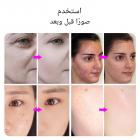 جهاز العلاج بالضوء LED، جهاز للعناية بالوجه، 7 ألوان، 222 خرزة ضوئية، رذاذ بخار، قابل للطي