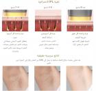 جهاز Mlay T8 (ذهبي داكن) لإزالة الشعر بالليزر IPL بشكل دائم، 500,000 ومضة، تبريد ثلجي، معتمد من إدارة الغذاء والدواء الأمريكية