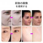 LED光療法マシン、フェイスケアデバイス、7色、222個のライトビーズ、スチームスプレー、折りたたみ式