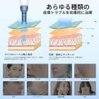 Dr. Pen A9 電動マイクロニードリングダーマペン、10個ナノラウンドピン針入り