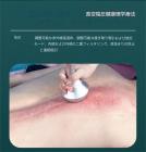 プロフェッショナル 80Khz 超音波キャビテーションマシン、9in1 オールインワン、ラジオ波、ボディスリミング彫刻装置、6つのEMSパッド付き