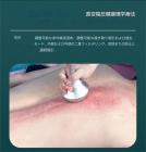 プロフェッショナル 80Khz 超音波キャビテーションマシン、9in1 オールインワン、ラジオ波、ボディスリミング彫刻装置、8 つの脂肪レーザーパッド付き