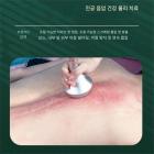 전문가용 80K 초음파 캐비테이션 머신, 6인1 무선 주파수 바디 슬리밍 조각 장치, EMS 패드 6개
