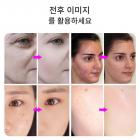 LED 광선 요법 기계 얼굴 관리 장치, 7가지 색상, 222개 빛 구슬, 나노 스팀 스프레이, 접이식