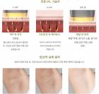 Mlay T8(다크 골드) IPL 레이저 영구 제모, 500000 플래시, 아이스 쿨링, FDA 인증
