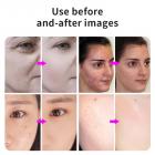 LED Light Therapy Machine Face Care Device, 7 Colors, 222 Light Beads, Nano Steam Spray, Foldable, US Plug