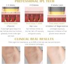 Mlay T8 (Dark Gold) IPL Laser Permanent Hair Removal, 500,000 Flashes, Ice Cooling, FDA Certified, US Plug